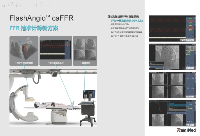 冠狀動脈造影血流儲備分數(shù)測量系統(tǒng)圖片3