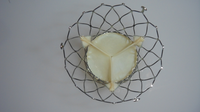 主動(dòng)脈瓣膜-5