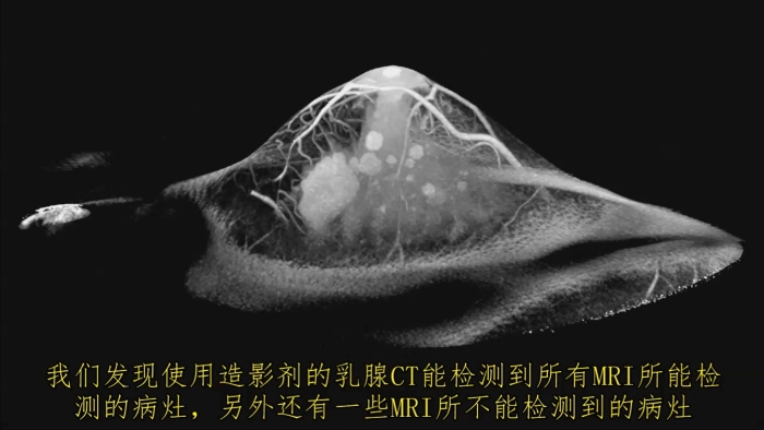 KBCT產(chǎn)品優(yōu)勢7