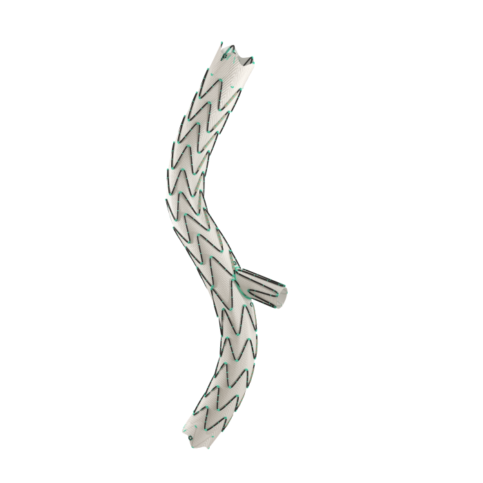 照片2-先健科技-髂動脈分叉支架