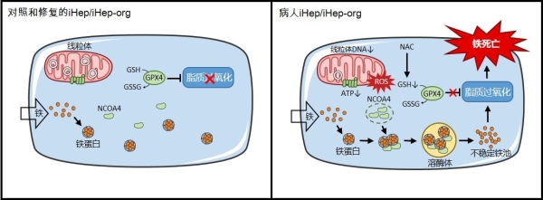 線粒體疾病肝細(xì)胞的全新鐵死亡模式、細(xì)胞器互作機(jī)制